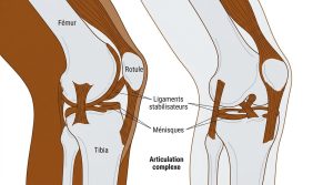 Comprendre et soigner le grasset du cheval | Guide santé
